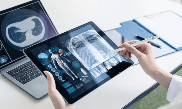 كيف يسهّل السجل الطبي الإلكتروني متابعة المرضى؟
